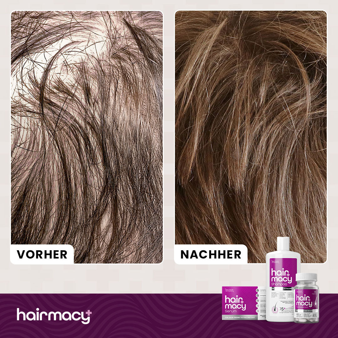 Serum zur Stimulierung des Haarwachstums Hairmacy