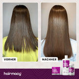 Umfassende Behandlung gegen Haarausfall Hairmacy