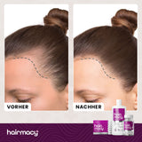 Shampoo für zu Haarausfall neigendes Haar Hairmacy