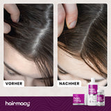 Shampoo für zu Haarausfall neigendes Haar Hairmacy