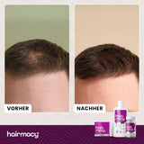 Serum zur Stimulierung des Haarwachstums Hairmacy