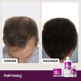 Shampoo für zu Haarausfall neigendes Haar Hairmacy