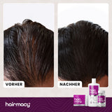 Shampoo für zu Haarausfall neigendes Haar Hairmacy