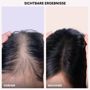 Hairmacy Wachstums-Serum für Frauen & Männer