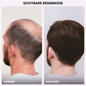 Hairmacy Wachstums-Serum für Frauen & Männer